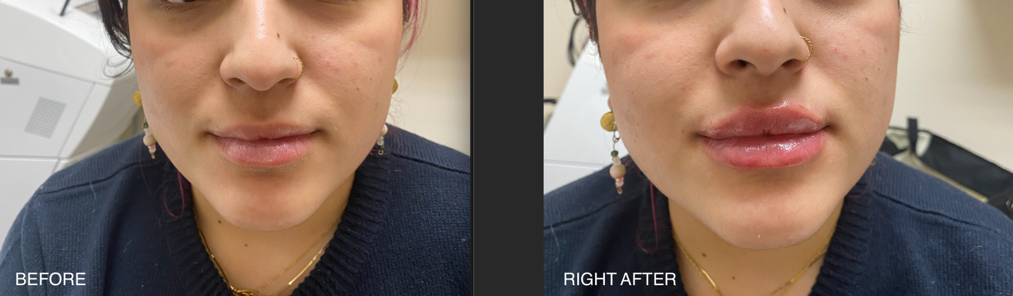 After skin quality case 2