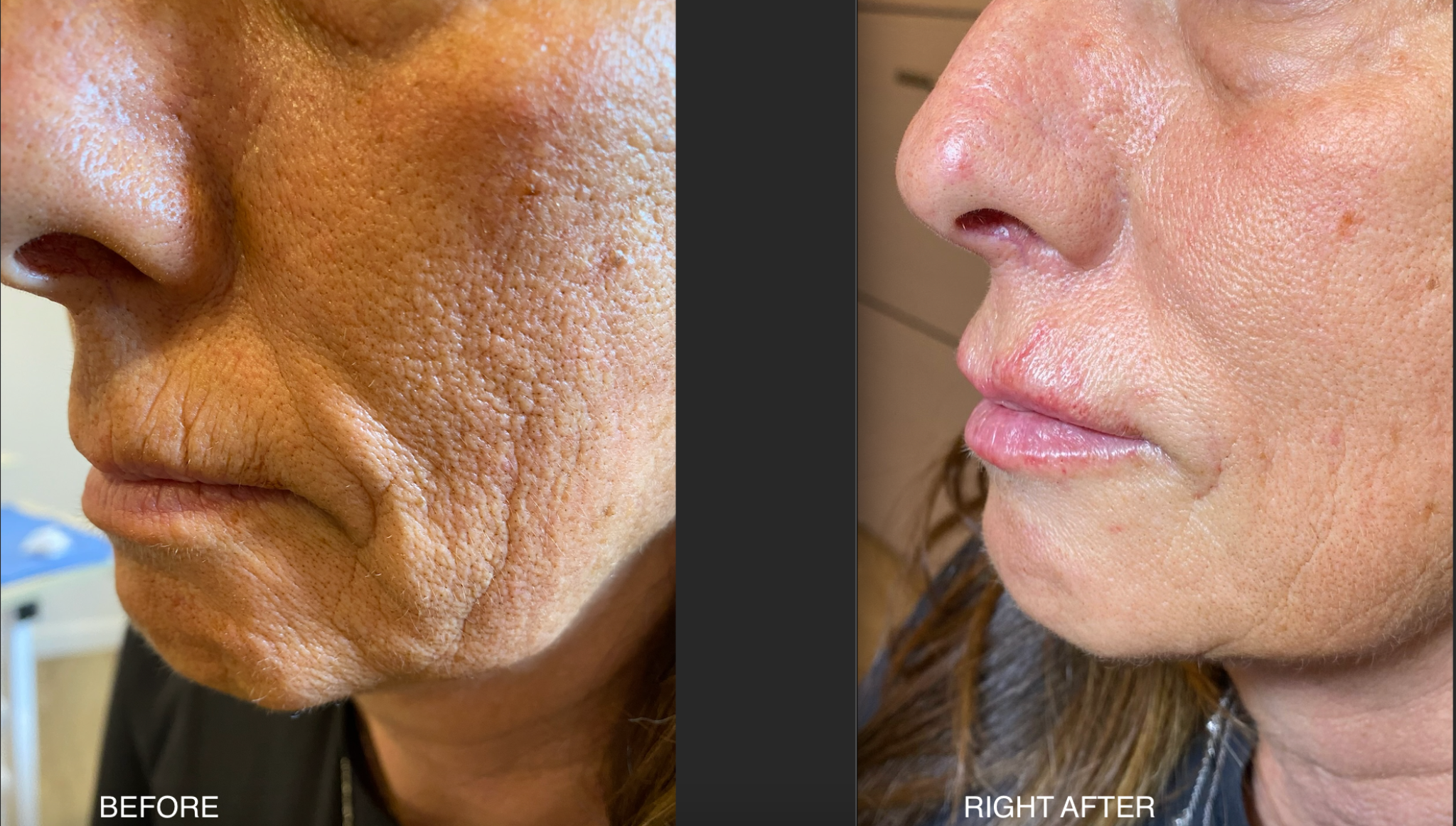 After skin quality case