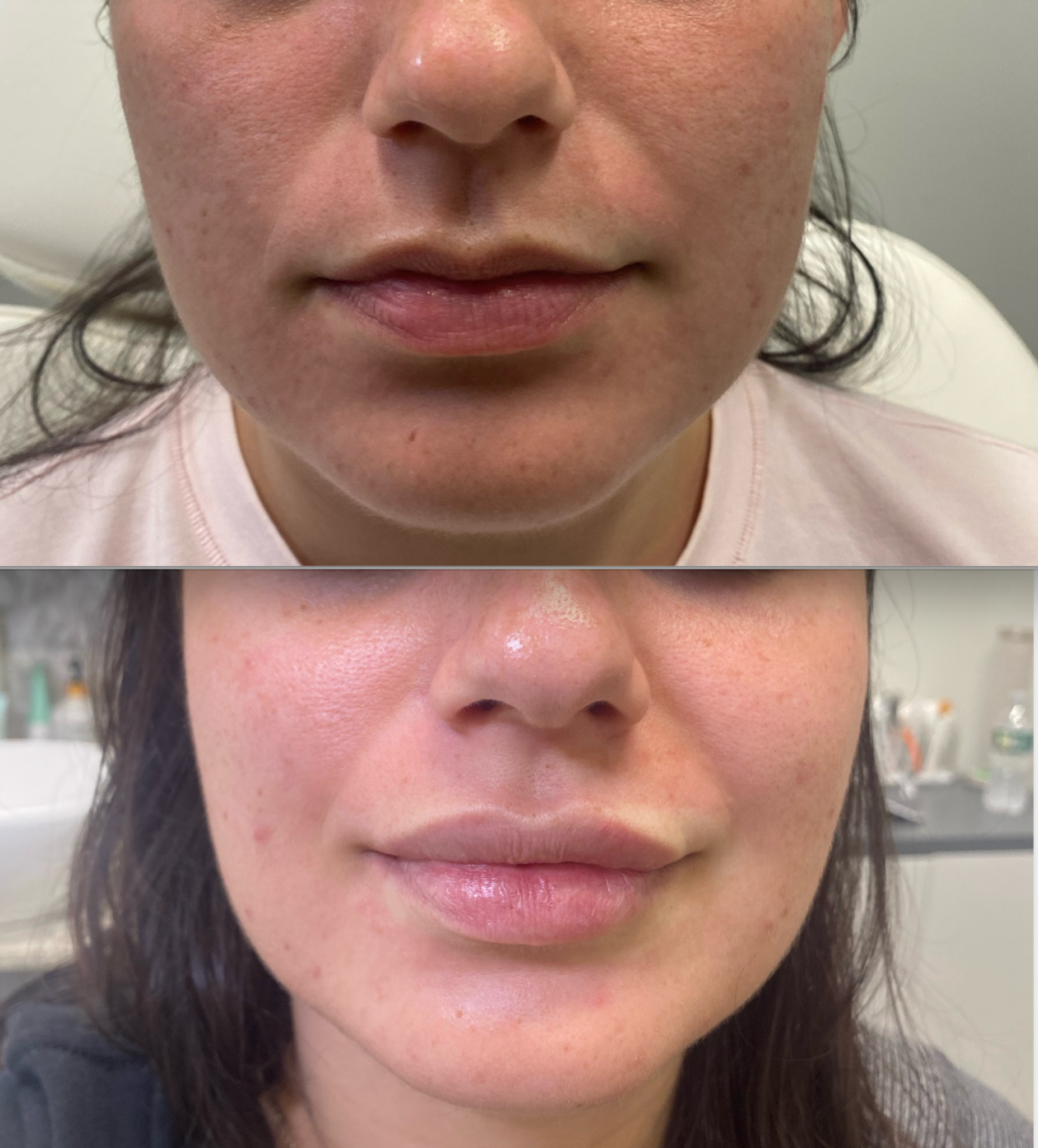 Before skin quality case 2