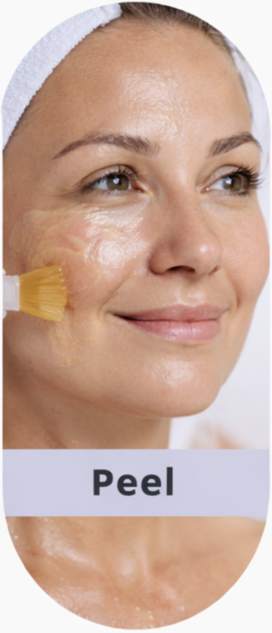 Chemical peel being applied to the cheek